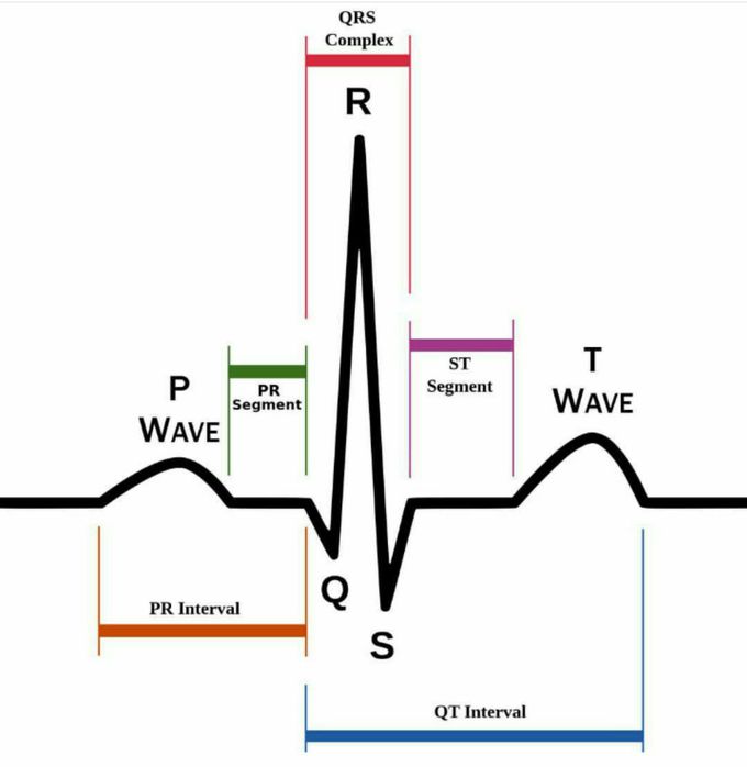 Simple EKG or ECG ☺