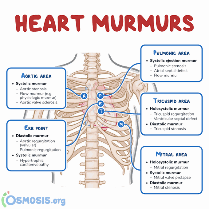 Auscultation sites of heart murmur
