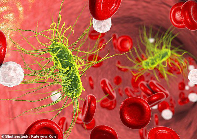 Managing the Dreaded Septic Shock!!