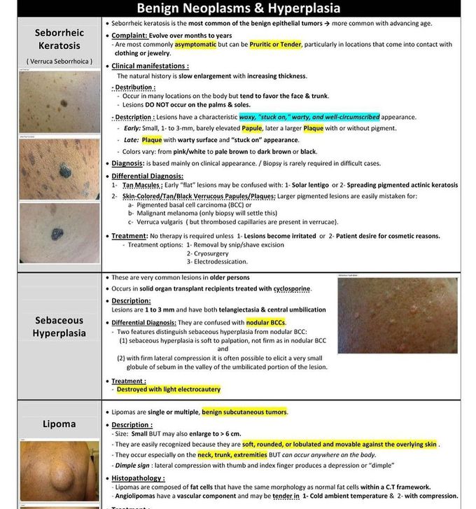 Benign Neoplasms and Hyperplasia