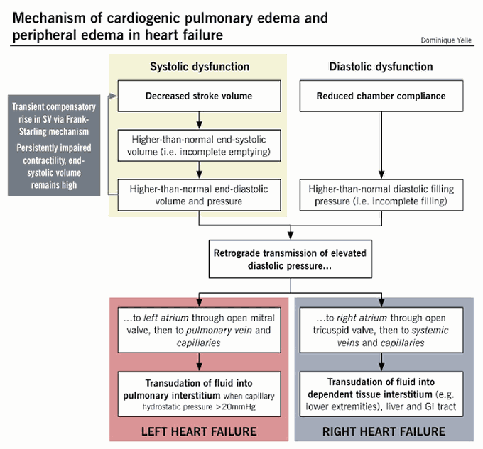 Left and Right Heart Failure