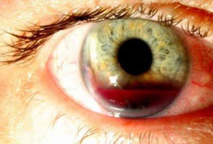 What is your diagnosis??