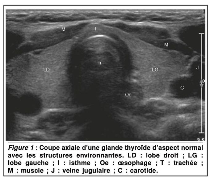 Thyroid