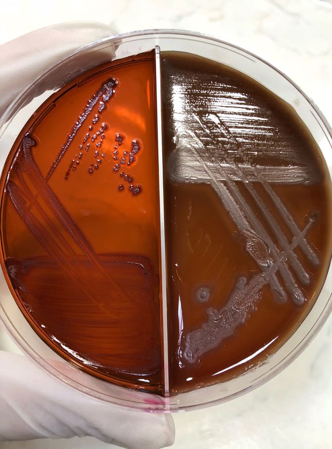 Pseudomonas aeruginosa on EMB and blood agars