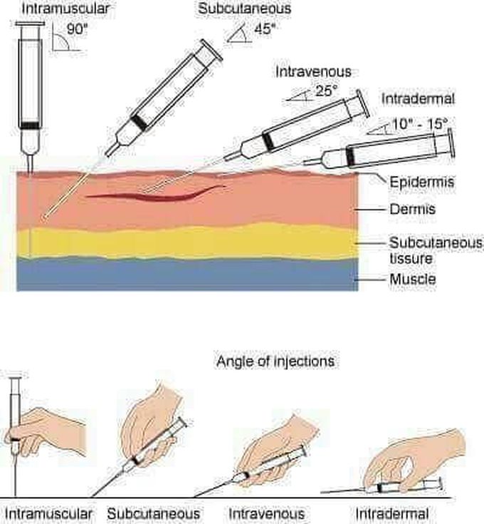 Angles of Injection