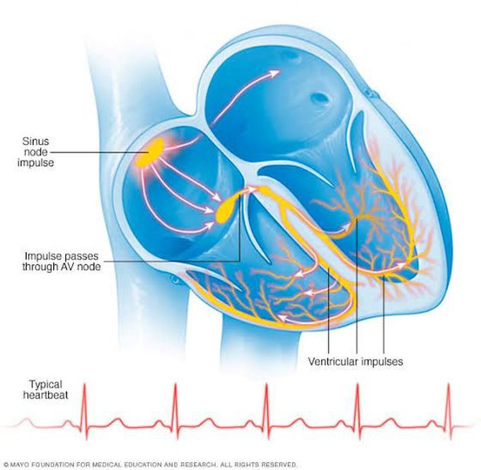Cardiac arrhythmias