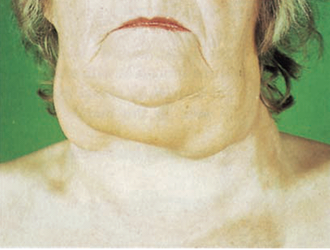 Diagnosis? And Treatment?