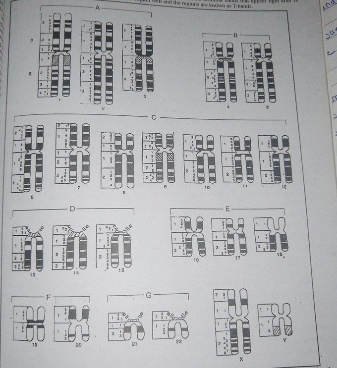 Karyotype pattern in human.... chromosome banding