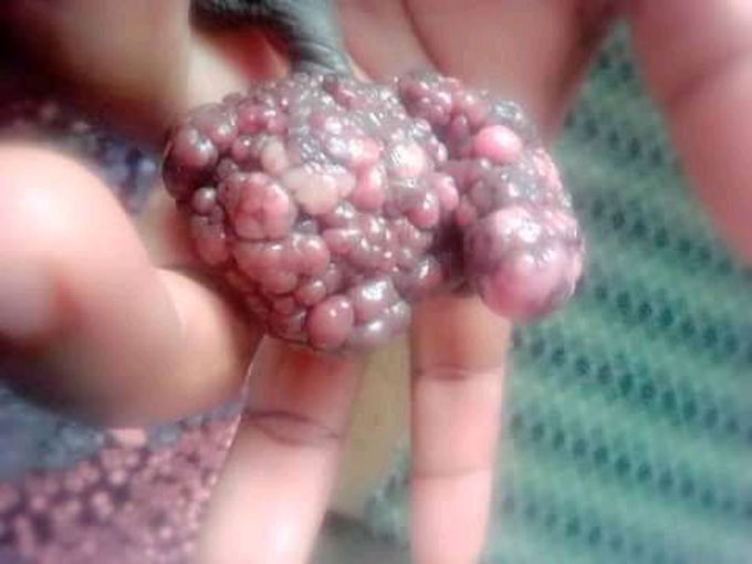 Name of disease, treatment, prevention
