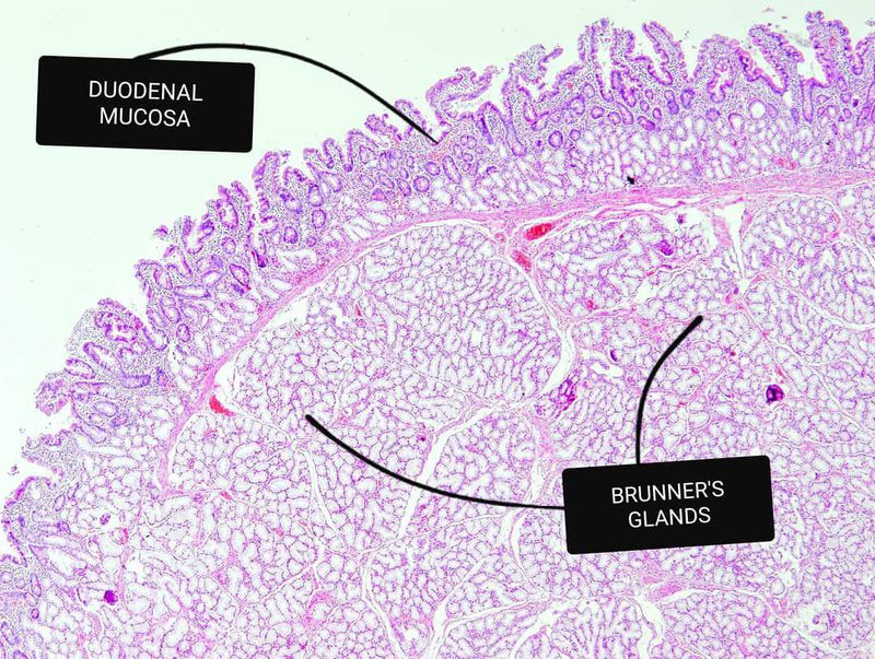 Brunner's glands hotsell in duodenum