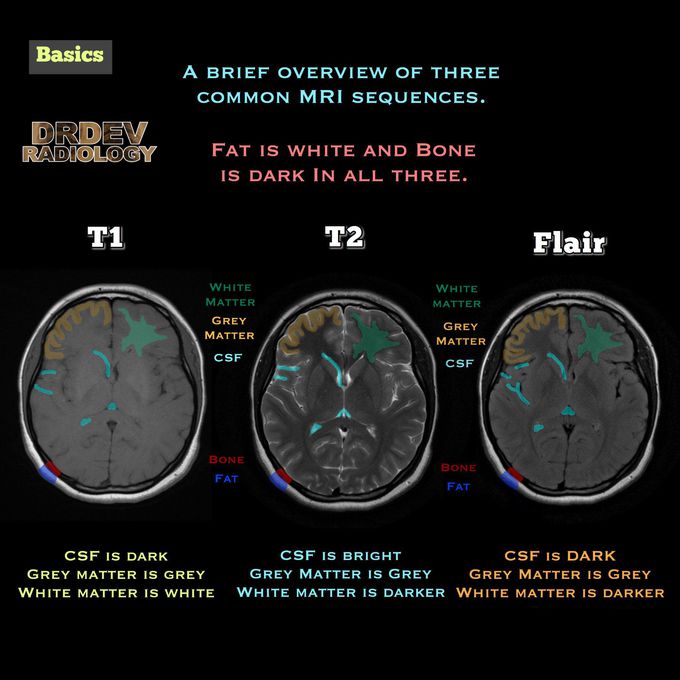 Difference Between T1, T2 and FLAIR