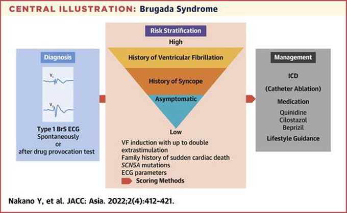 How is Brugada syndrome diagnosed?