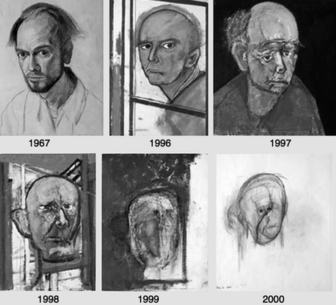 A self-portrait made by an artist with alzheimer.
