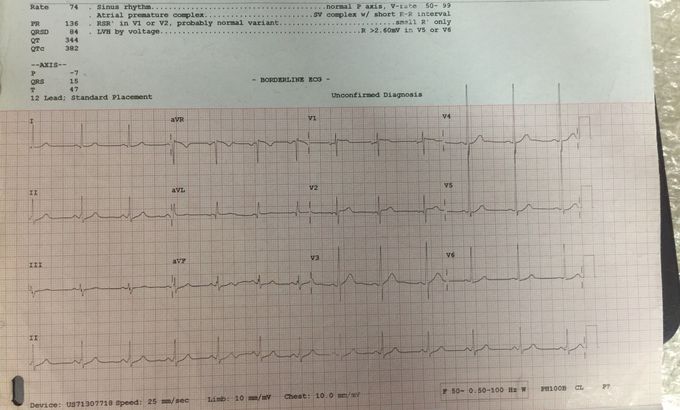 Diagnosis