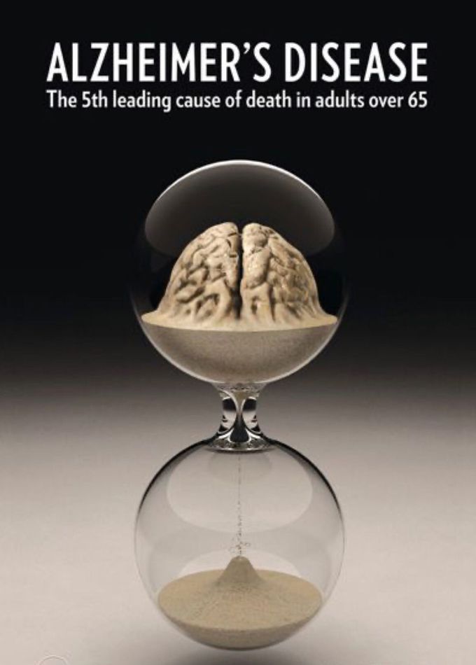 ALZHEIMER'S DISEASE The 5th leading cause of death in adults over 65. 🧠⏳❤️