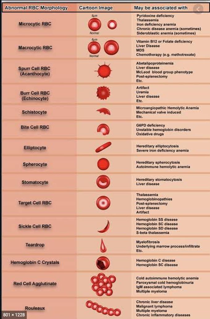 Abnormal RBC morphology