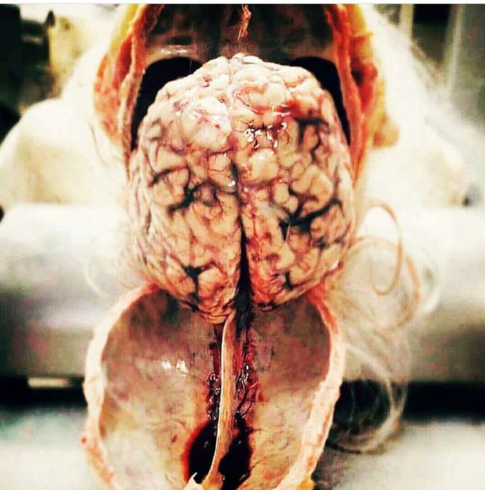 Nervous system