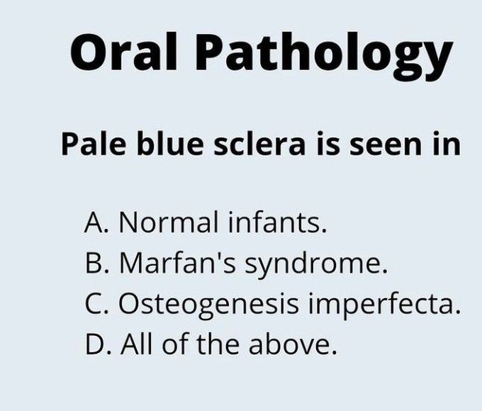 Pale Blue Sclera