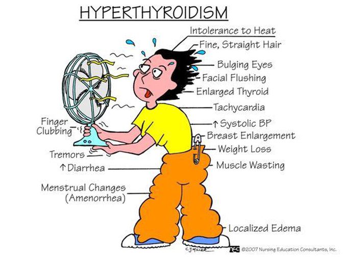 Hyperthyroidism