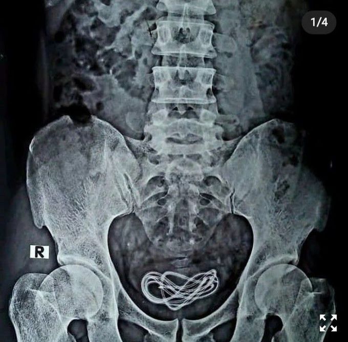 general trauma surgery