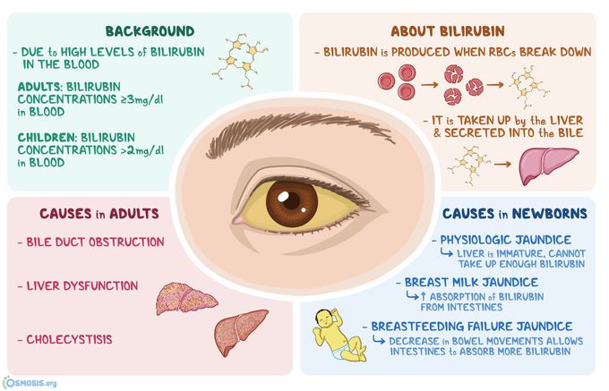 Scleral icterus