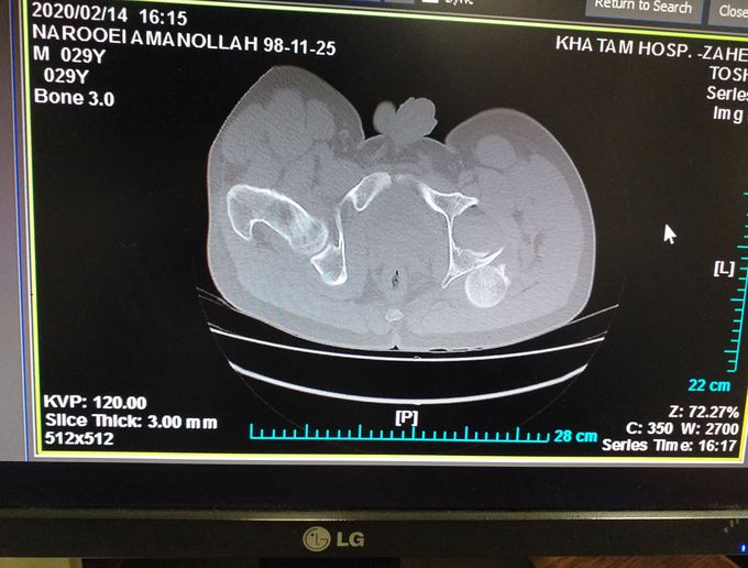 What is your diagnosis?