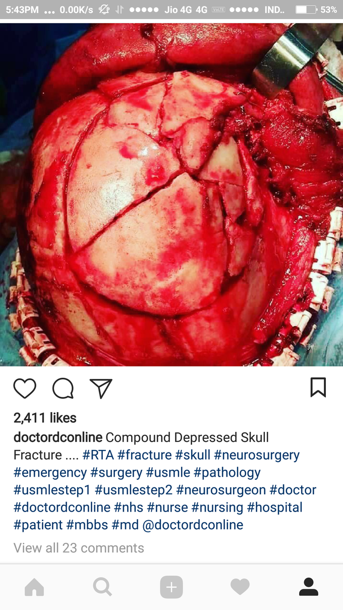 How it can be happend