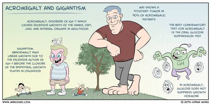 Acromegaly and Gigantism