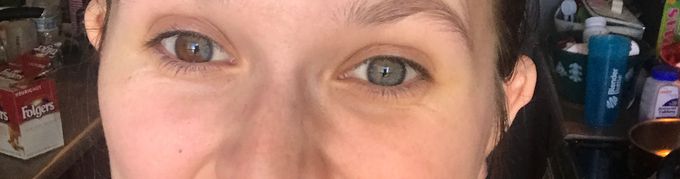 I was born with Heterochromia