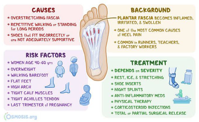 Planter Fasciitis