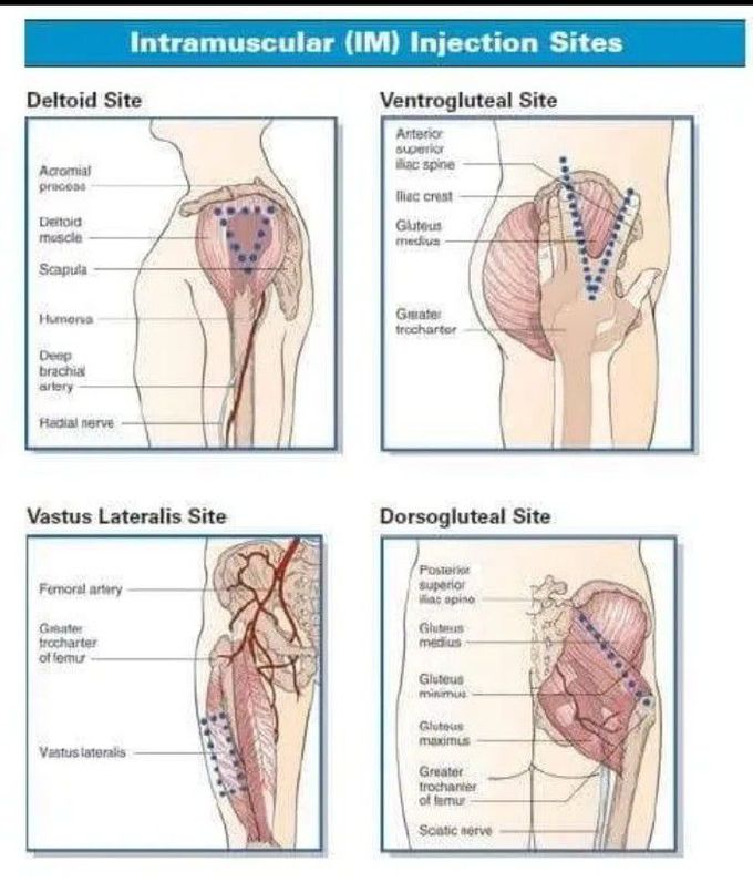 Intramuscular injection sites