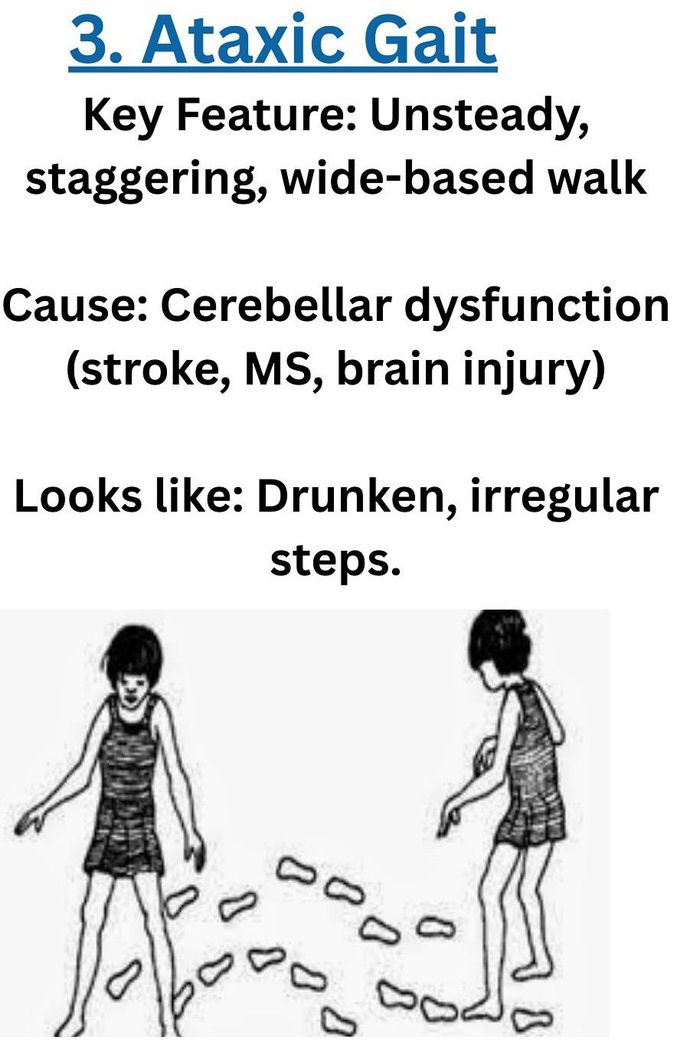 Ataxic Gait