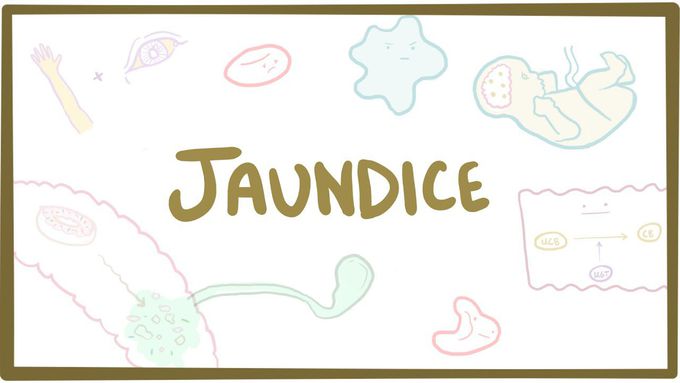 Jaundice
