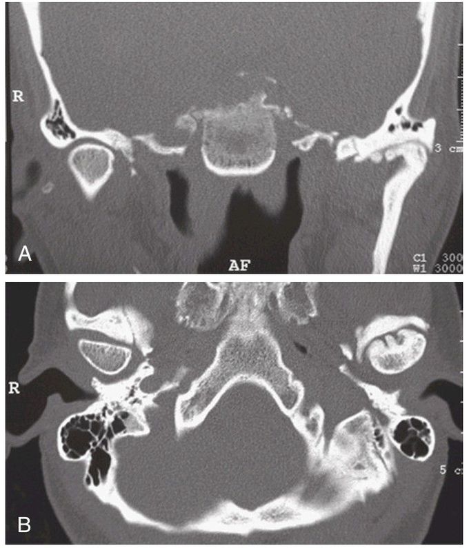 Computed tomography.