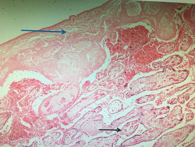 What is the  cross section ?