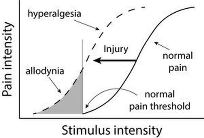 Common causes of allodynia - MEDizzy