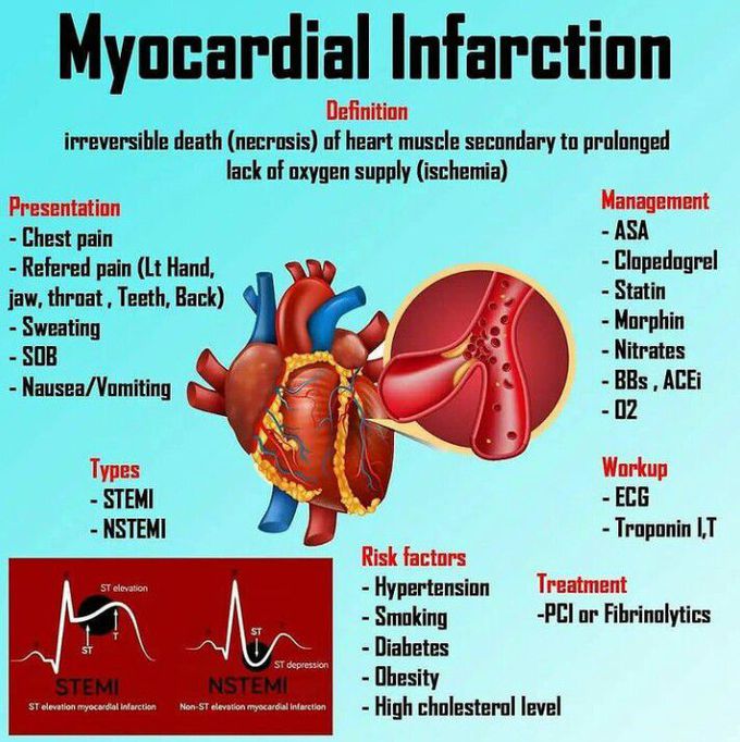 Myocardial Infarction