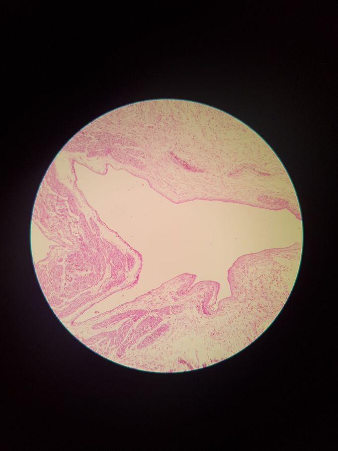 Fetal Heart