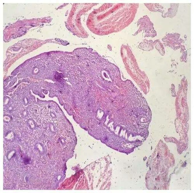 Endometrium