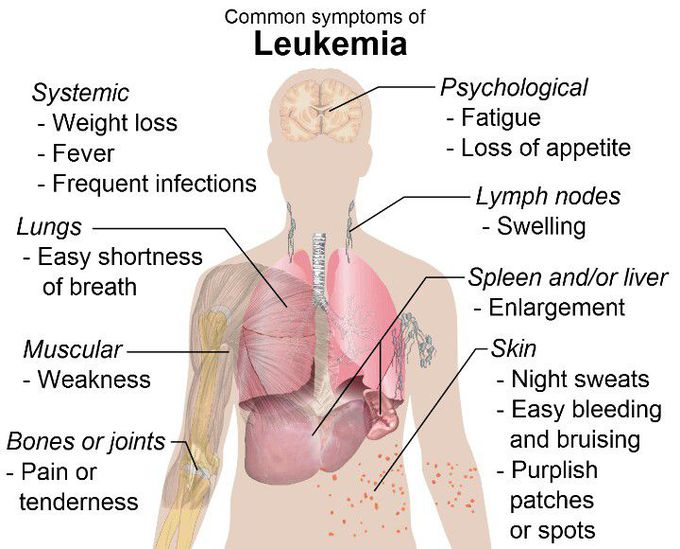 Leukemia