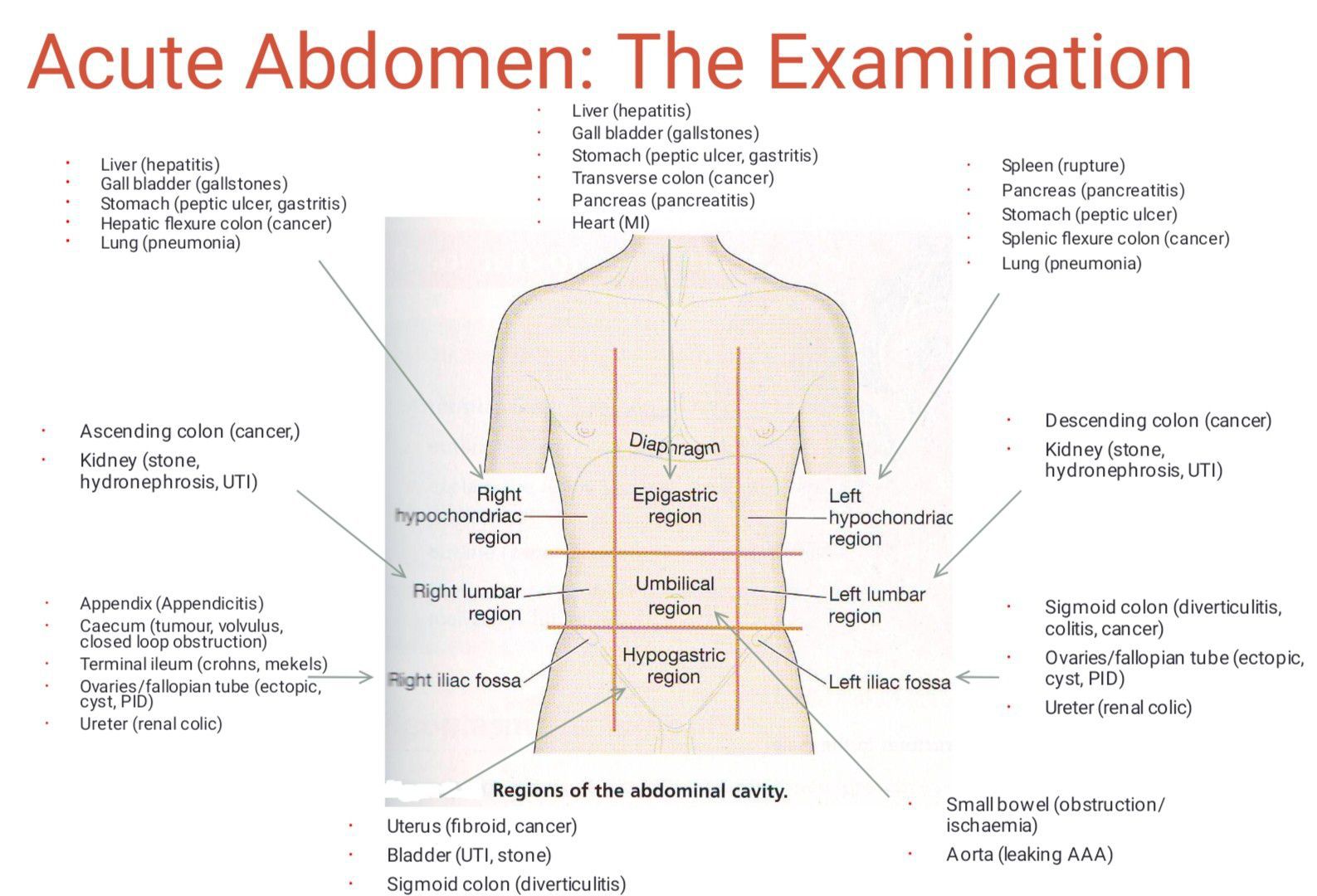 Acute Abdomen Medizzy