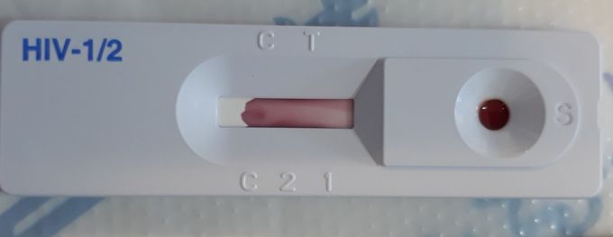 HIV rapid test