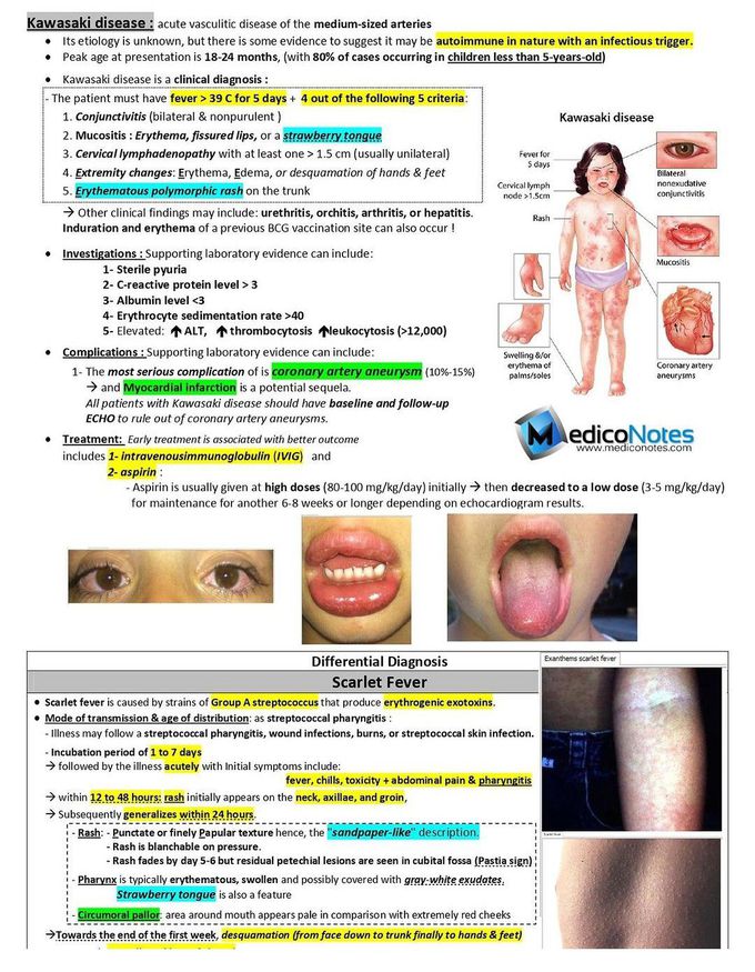 Kawasaki Disease- I