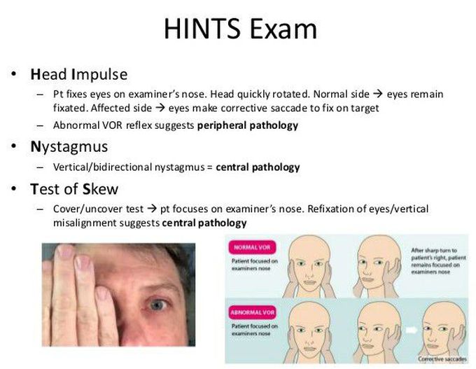 The best test for assessment of vertigo