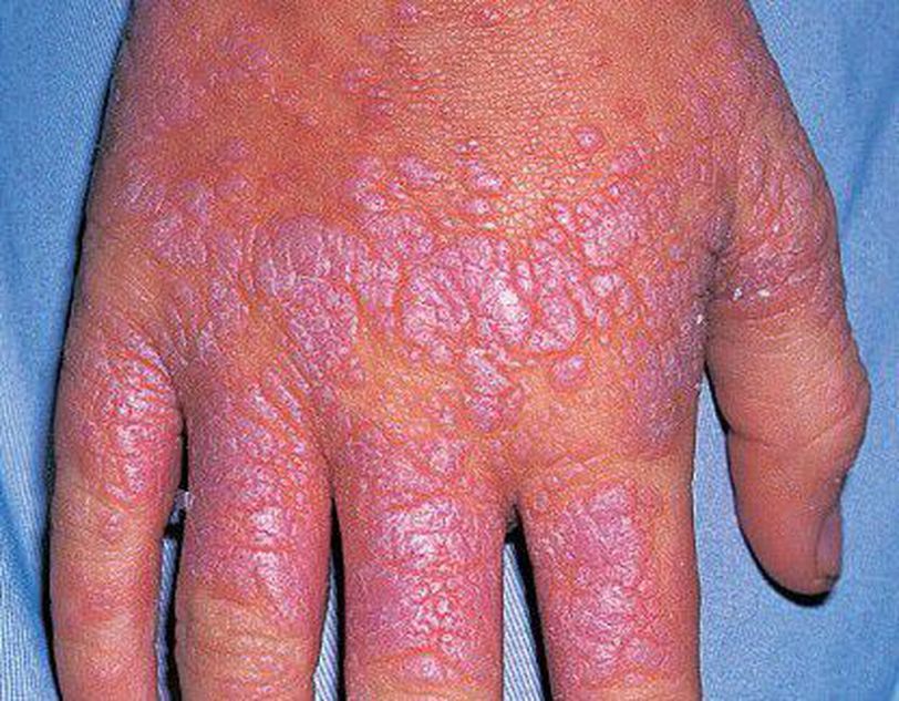 What is your diagnosis? - MEDizzy