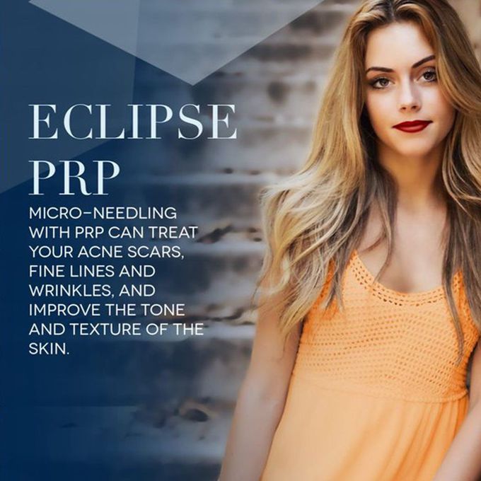 Eclipse PRP treatments
