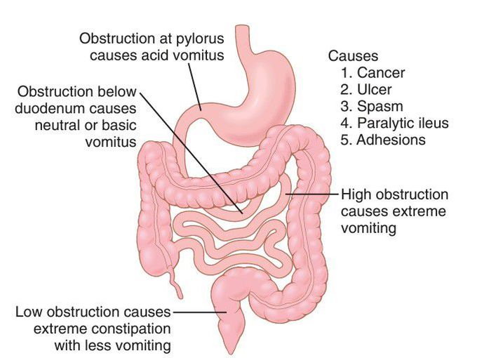 GIT obstruction