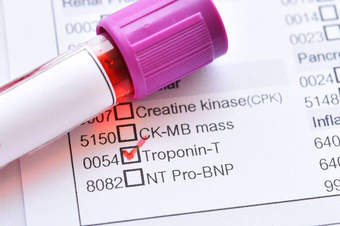 Raised Troponin: Acute Coronary Syndrome, or Something Else?