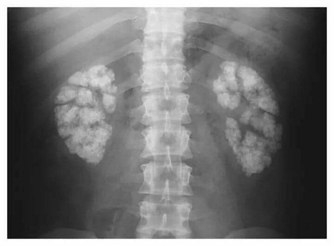What’s this diagnosis