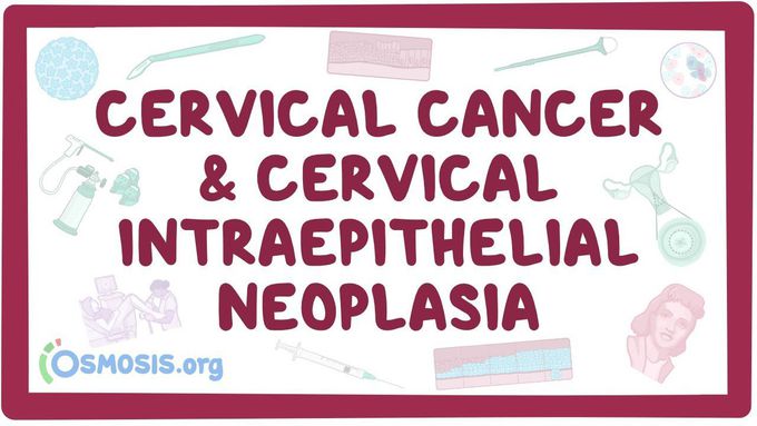 Cervical Cancer & Cervical Intraepithelial Neoplasia